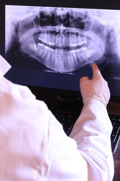 Best Emergency Dental Extractions in Fulton, MD